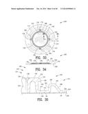 Closure System for an Ostomy Pouch and Related Methods diagram and image