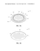 Closure System for an Ostomy Pouch and Related Methods diagram and image