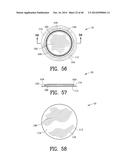 Closure System for an Ostomy Pouch and Related Methods diagram and image