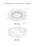 Closure System for an Ostomy Pouch and Related Methods diagram and image