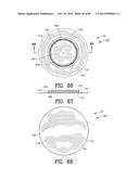 Closure System for an Ostomy Pouch and Related Methods diagram and image