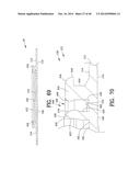 Closure System for an Ostomy Pouch and Related Methods diagram and image