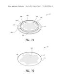 Closure System for an Ostomy Pouch and Related Methods diagram and image