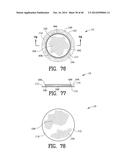 Closure System for an Ostomy Pouch and Related Methods diagram and image