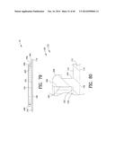 Closure System for an Ostomy Pouch and Related Methods diagram and image