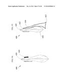 Closure System for an Ostomy Pouch and Related Methods diagram and image