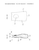 Closure System for an Ostomy Pouch and Related Methods diagram and image