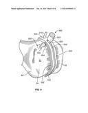 Patient-Specific-Bone-Cutting Guidance Instruments And Methods diagram and image