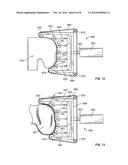 Patient-Specific-Bone-Cutting Guidance Instruments And Methods diagram and image