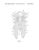 Tenodesis Implant diagram and image