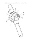 CLOT BUSTER ASPIRATION CATHETER diagram and image