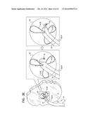 FOSSA OVALIS PENETRATION diagram and image