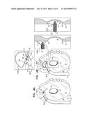 FOSSA OVALIS PENETRATION diagram and image