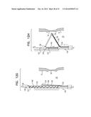 FOSSA OVALIS PENETRATION diagram and image