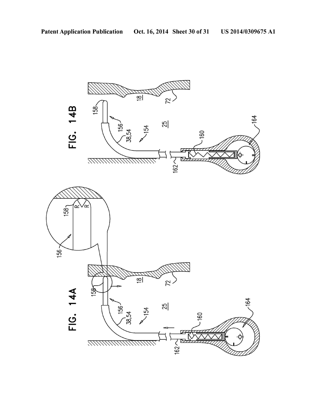 FOSSA OVALIS PENETRATION - diagram, schematic, and image 31