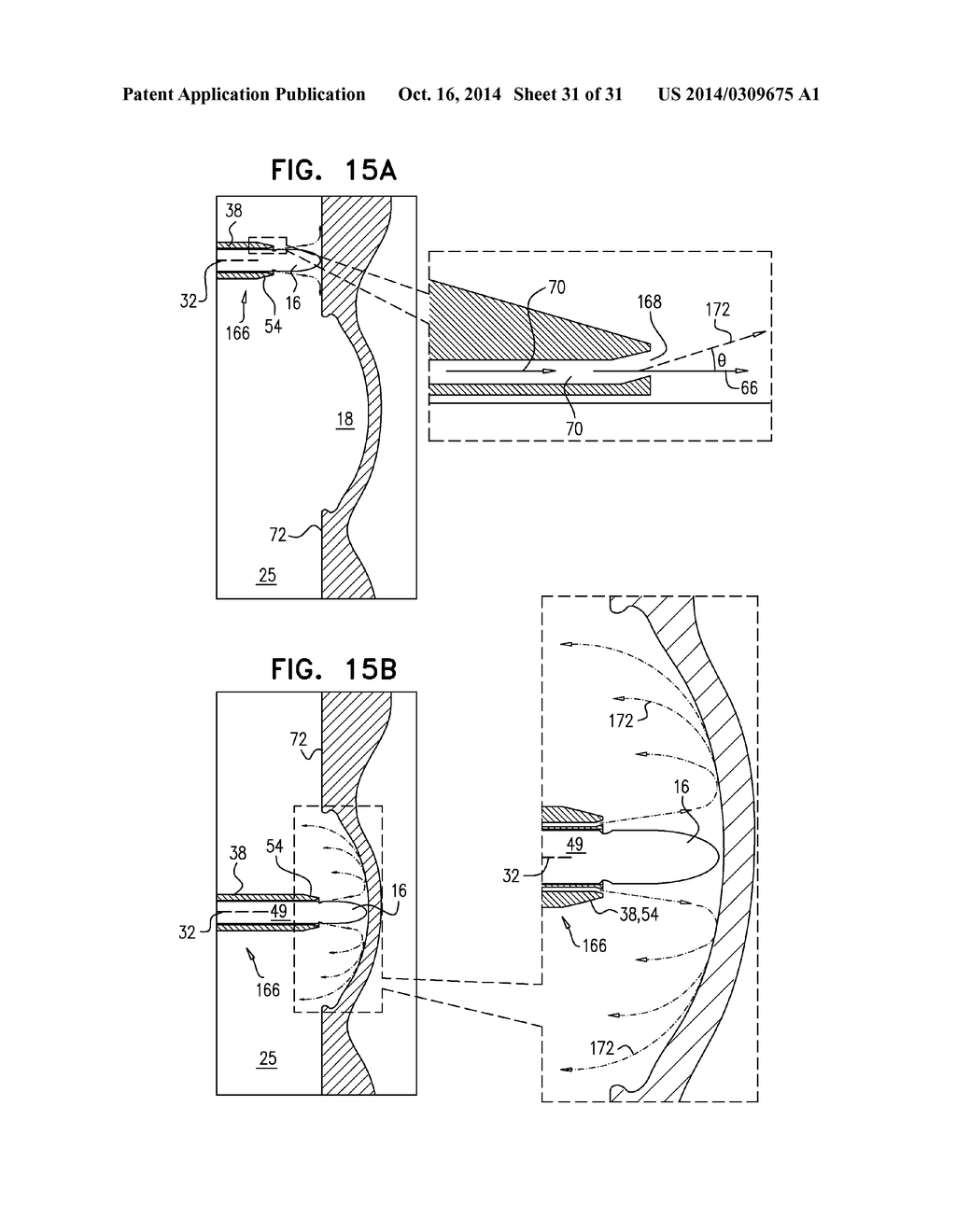 FOSSA OVALIS PENETRATION - diagram, schematic, and image 32