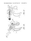 MINIMALLY INVASIVE SURGICAL DEVICES AND METHODS diagram and image