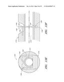 MINIMALLY INVASIVE SURGICAL DEVICES AND METHODS diagram and image