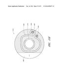 MINIMALLY INVASIVE SURGICAL DEVICES AND METHODS diagram and image