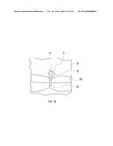 KNOTLESS FILAMENT ANCHOR FOR SOFT TISSUE REPAIR diagram and image