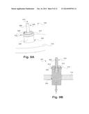 CERVICAL POP RIVET LOCKING MECHANISM diagram and image