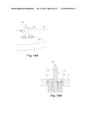 CERVICAL POP RIVET LOCKING MECHANISM diagram and image