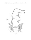 System and Method for Electrical Stimulation of Anorectal Structures to     Treat Anal Dysfunction diagram and image