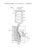 System and Method for Electrical Stimulation of Anorectal Structures to     Treat Anal Dysfunction diagram and image