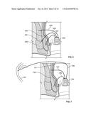 System and Method for Electrical Stimulation of Anorectal Structures to     Treat Anal Dysfunction diagram and image