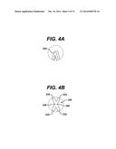 ENDOPROTHESIS DELIVERY SYSTEM diagram and image