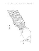 ENDOPROTHESIS DELIVERY SYSTEM diagram and image