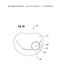 BLOOD FLOW CONTROLLING APPARATUS diagram and image