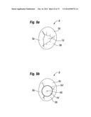 BLOOD FLOW CONTROLLING APPARATUS diagram and image