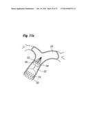 BLOOD FLOW CONTROLLING APPARATUS diagram and image