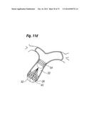 BLOOD FLOW CONTROLLING APPARATUS diagram and image