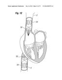 BLOOD FLOW CONTROLLING APPARATUS diagram and image