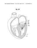 BLOOD FLOW CONTROLLING APPARATUS diagram and image