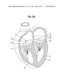 BLOOD FLOW CONTROLLING APPARATUS diagram and image