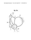 BLOOD FLOW CONTROLLING APPARATUS diagram and image