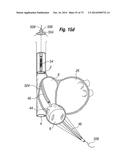 BLOOD FLOW CONTROLLING APPARATUS diagram and image