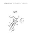 BLOOD FLOW CONTROLLING APPARATUS diagram and image