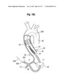 BLOOD FLOW CONTROLLING APPARATUS diagram and image