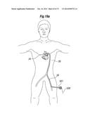 BLOOD FLOW CONTROLLING APPARATUS diagram and image