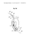 BLOOD FLOW CONTROLLING APPARATUS diagram and image