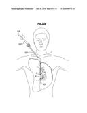 BLOOD FLOW CONTROLLING APPARATUS diagram and image