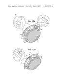 ACCOMMODATIVE INTRAOCULAR LENS diagram and image