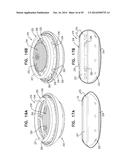 ACCOMMODATIVE INTRAOCULAR LENS diagram and image