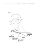 Intraocular Lens diagram and image