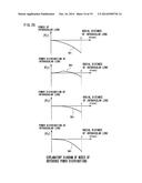 Intraocular Lens diagram and image