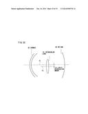 Intraocular Lens diagram and image